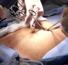 لاپاراسکوپی و بیماری های گوارشی دکتر مجتبی احمدی نژاد