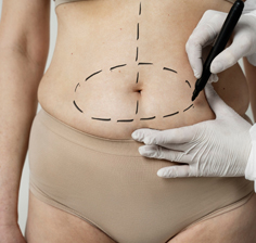 جراحی زیبایی سینه و شکم دکتر مجتبی احمدی نژاد