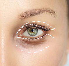 بلفاروپلاستی دکتر مجتبی احمدی نژاد